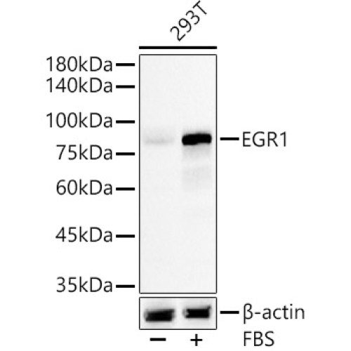 EGR1 Rabbit mAb