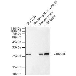 CDK5R1 Rabbit mAb