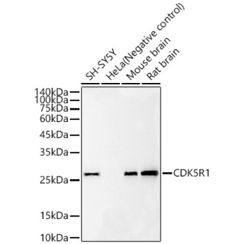 CDK5R1 Rabbit mAb
