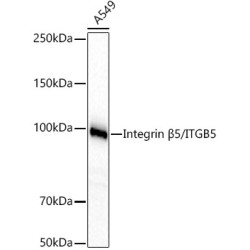 Integrin β5/ITGB5 Rabbit mAb