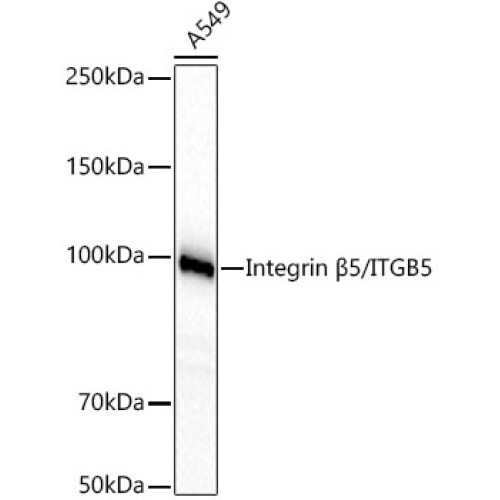 Integrin β5/ITGB5 Rabbit mAb