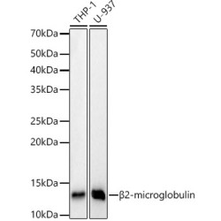 [KD Validated] beta 2 Microglobulin Rabbit mAb