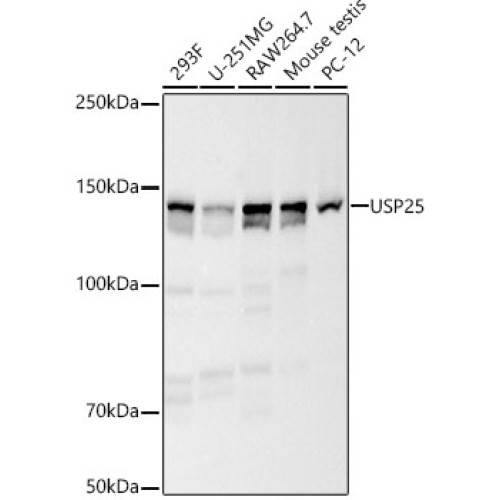 USP25 Rabbit mAb