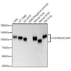 CD166/ALCAM Rabbit mAb