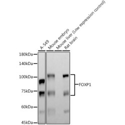 FOXP1 Rabbit mAb