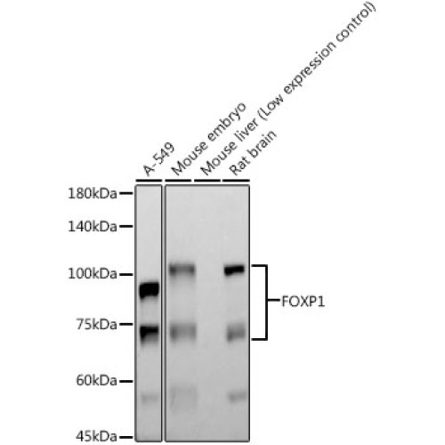 FOXP1 Rabbit mAb
