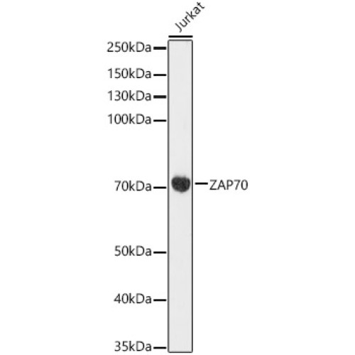 ZAP70 Rabbit mAb