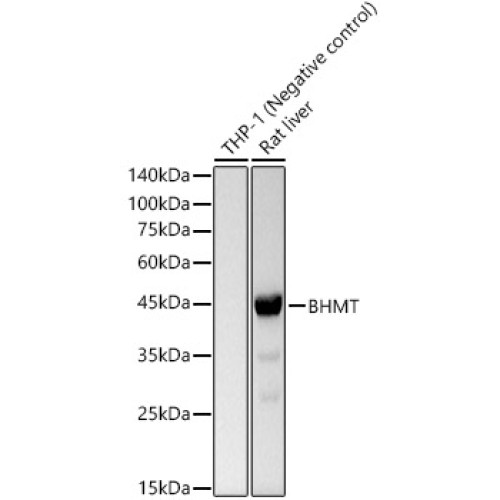 BHMT Rabbit mAb