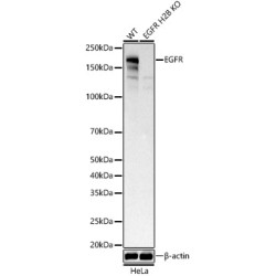 [KD Validated] EGFR Rabbit mAb