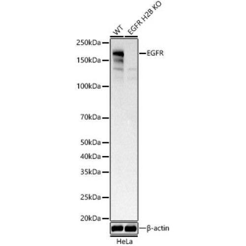 [KD Validated] EGFR Rabbit mAb