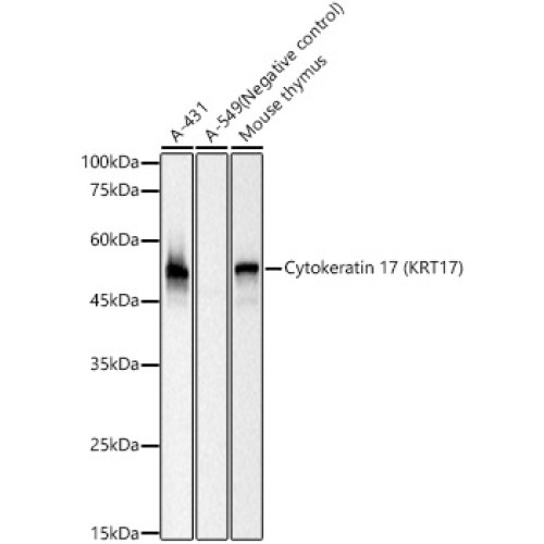 Cytokeratin 17 (KRT17) Rabbit mAb