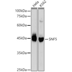 [KO Validated] SMARCB1/SNF5 Rabbit mAb