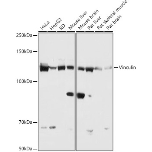Vinculin Rabbit mAb