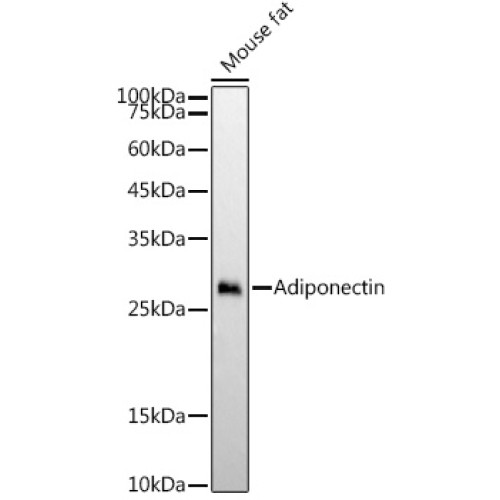 Adiponectin Rabbit mAb