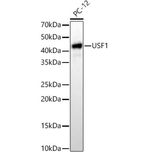 [KD Validated] USF1 Rabbit mAb