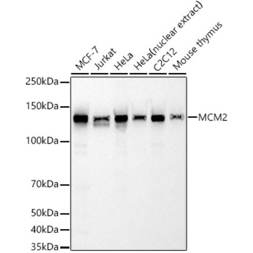 MCM2 Rabbit mAb