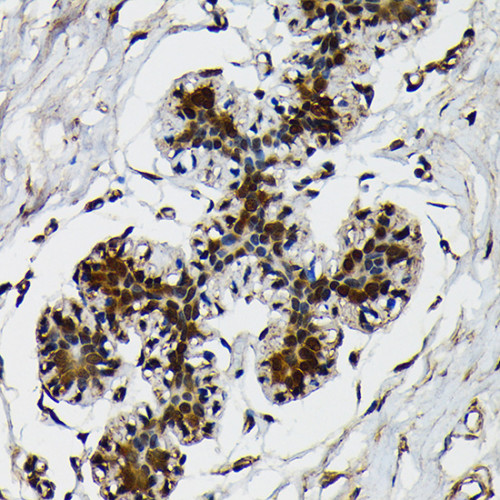 Ubiquitin Rabbit mAb