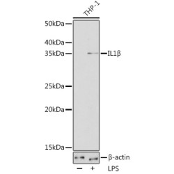 IL1β Rabbit mAb