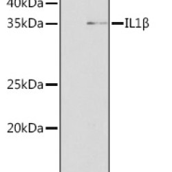 IL1β Rabbit mAb