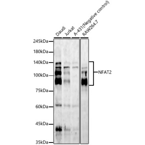 NFAT2 Rabbit mAb