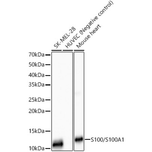 S100/S100A1 Rabbit mAb