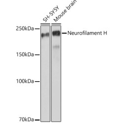 Neurofilament H Rabbit mAb