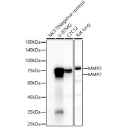 MMP2 Rabbit mAb