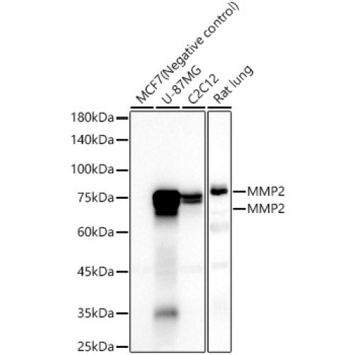 MMP2 Rabbit mAb