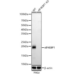 [KD Validated] eIF4EBP1 Rabbit mAb