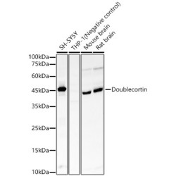 Doublecortin Rabbit mAb