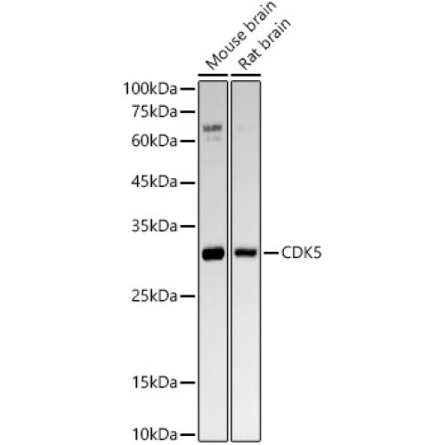 [KO Validated] CDK5 Rabbit mAb