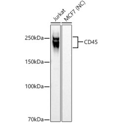 CD45 Rabbit mAb