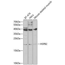 HSPB2 Rabbit pAb