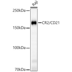CR2/CD21 Rabbit mAb