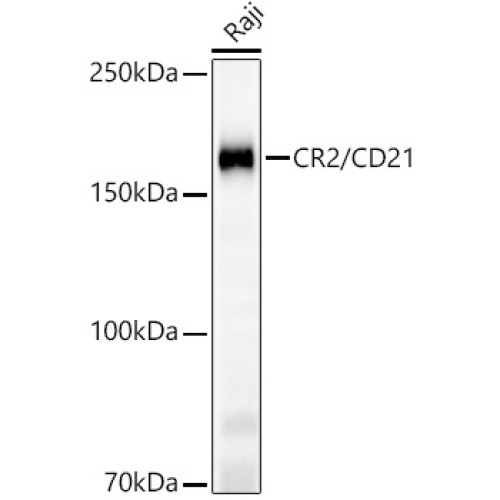 CR2/CD21 Rabbit mAb