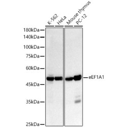 eEF1A1 Rabbit mAb