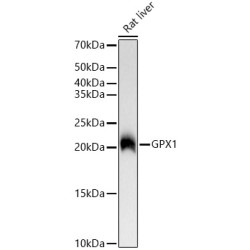 GPX1 Rabbit mAb