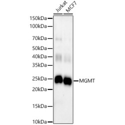 MGMT Rabbit mAb
