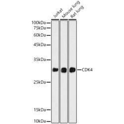 CDK4 Rabbit mAb