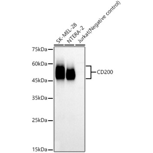 CD200 Rabbit mAb