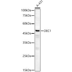[KD Validated] DEC1 Rabbit mAb
