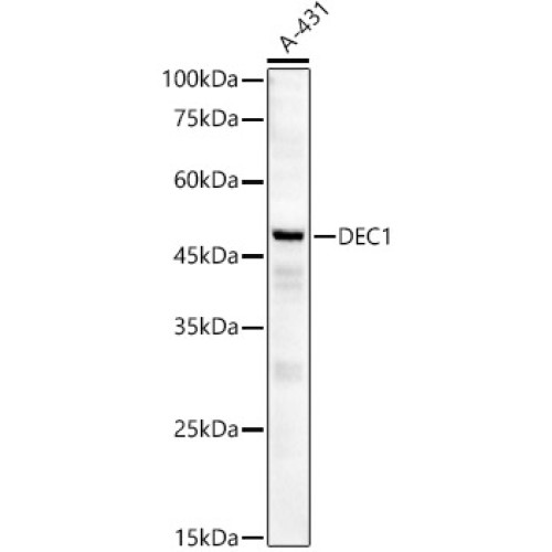 [KD Validated] DEC1 Rabbit mAb