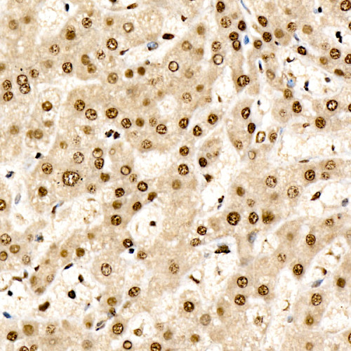 CHD4 Rabbit mAb
