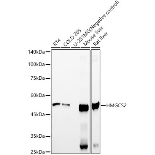 HMGCS2 Rabbit mAb