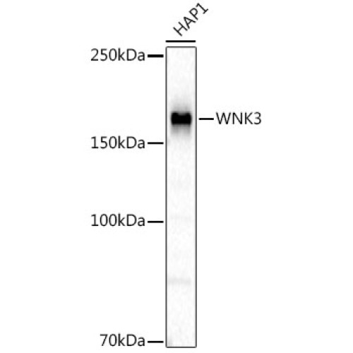 WNK3 Rabbit mAb