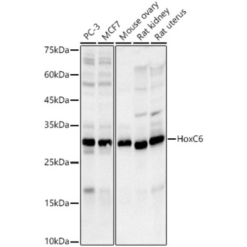 HoxC6 Rabbit mAb