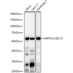 HRPT2 / CDC73 Rabbit mAb