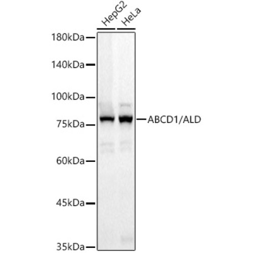 ABCD1 / ALD Rabbit mAb