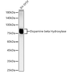 Dopamine beta Hydroxylase Rabbit mAb