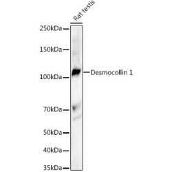 Desmocollin 1 Rabbit mAb